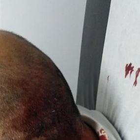 الناشط فراس بو حاطوم يتعرض للضرب المبرح