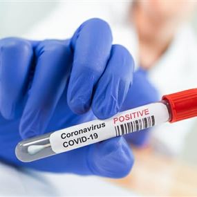 وزارة الصحة: 63 اصابة جديدة بفيروس كورونا