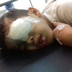 لعبة "القنبلة" النارية تنفجر في عين الطفل "عبدالرحمن"