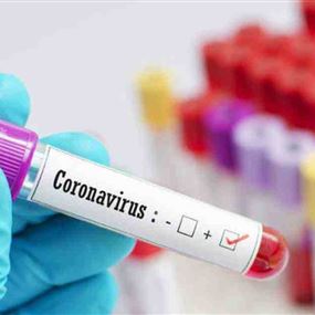 وزارة الصحة: حالتا وفاة و129 إصابة جديدة بفيروس كورونا