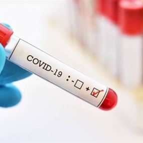 وزارة الصحة: 6154 اصابة جديدة بفيروس كورونا و44 حالة وفاة