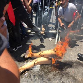 بالصور: عسكري مُقعد يحرق اطرافه الاصطناعية