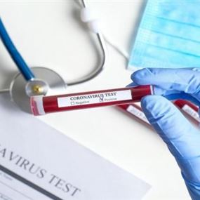 وزارة الصحة: 12 حالة وفاة و1520 إصابة جديدة بفيروس كورونا