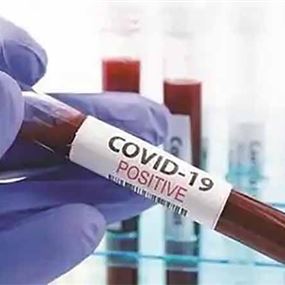 وزارة الصحة: 182 إصابة جديدة بفيروس كورونا وحالة وفاة