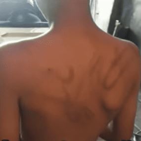 طفل يتعرض للتعذيب الوحشي من قبل عمه (فيديو)