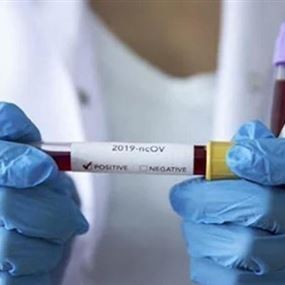 وزارة الصحة: 7 حالات وفاة و662 إصابة جديدة بفيروس كورونا