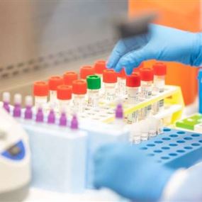 وزارة الصحة: 75 إصابة جديدة بفيروس كورونا